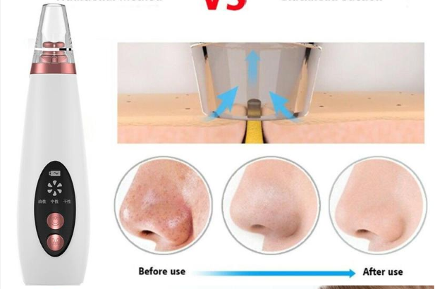 Pure Skin Rechargeable Blackhead Remover Machine Pure Skin Rechargeable Blackhead Remover Machine